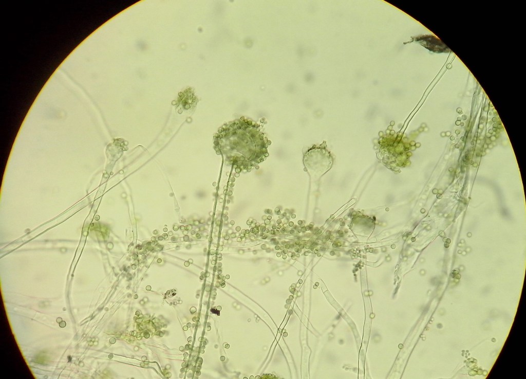 Une vue d'Aspergillus oryzae au microscope